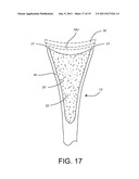 Shoulder Prosthesis Assembly having Glenoid Rim Replacement Structure diagram and image