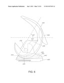 High Performance Knee Prostheses diagram and image