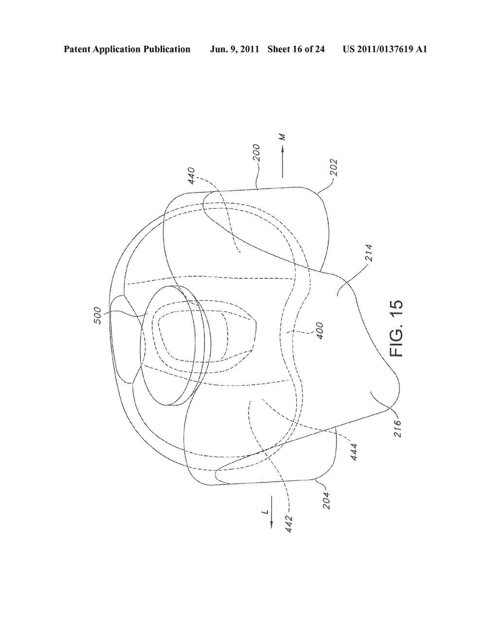 High Performance Knee Prostheses - diagram, schematic, and image 17