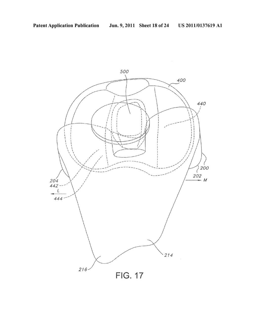 High Performance Knee Prostheses - diagram, schematic, and image 19