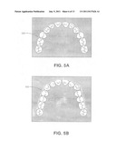 SYSTEM AND METHOD FOR AUTOMATED CONSTRUCTION OF ORTHODONTIC REFERENCE     OBJECTS diagram and image