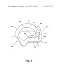 Angle Guide Plate and System for Securing a Rail diagram and image