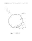 FUEL FILLER CAP diagram and image