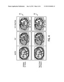 SYSTEM AND METHOD FOR QUANTITATIVE SPECIES SIGNAL SEPARATION USING MR     IMAGING diagram and image