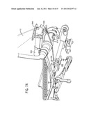 PATIENT POSITIONING SYSTEM FOR PANORAMIC DENTAL RADIATION IMAGING SYSTEM diagram and image