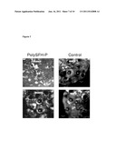 Polymerized Hemoglobin Media and Its Use in Isolation and Transplantation     of Islet Cells diagram and image