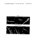 COMPOSITIONS AND METHODS FOR TREATMENT OF EAR DISORDERS diagram and image