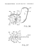 ORTHODONTIC TOOTH RETENTION SYSTEM diagram and image