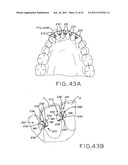ORTHODONTIC TOOTH RETENTION SYSTEM diagram and image