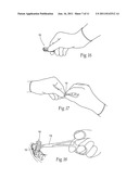 Compositions, assemblies, and methods applied during or after a dental     procedure to ameliorate fluid loss and/or promote healing, using a     hydrophilic polymer sponge structure such as chitosan diagram and image