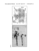 PROCOLLAGEN C-PROTEINASE ENHANCER (PCPE) BIOMARKER FOR BONE FORMATION diagram and image