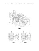 MIDDLE EAR IMPLANT AND METHOD diagram and image