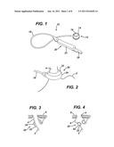 Apparatus for Completing Implantation of Gastric Band diagram and image