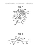 Apparatus for Completing Implantation of Gastric Band diagram and image