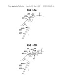 Apparatus for Completing Implantation of Gastric Band diagram and image