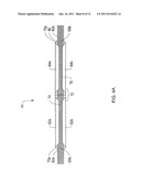 SYSTEMS, METHODS AND DEVICES RELATING TO A REMOVABLE SLEEVE FOR AN     IMPLANTABLE SLING diagram and image