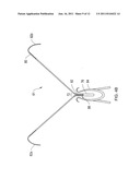 SYSTEMS, METHODS AND DEVICES RELATING TO A REMOVABLE SLEEVE FOR AN     IMPLANTABLE SLING diagram and image