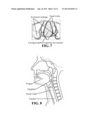 AIRWAY MANAGEMENT diagram and image