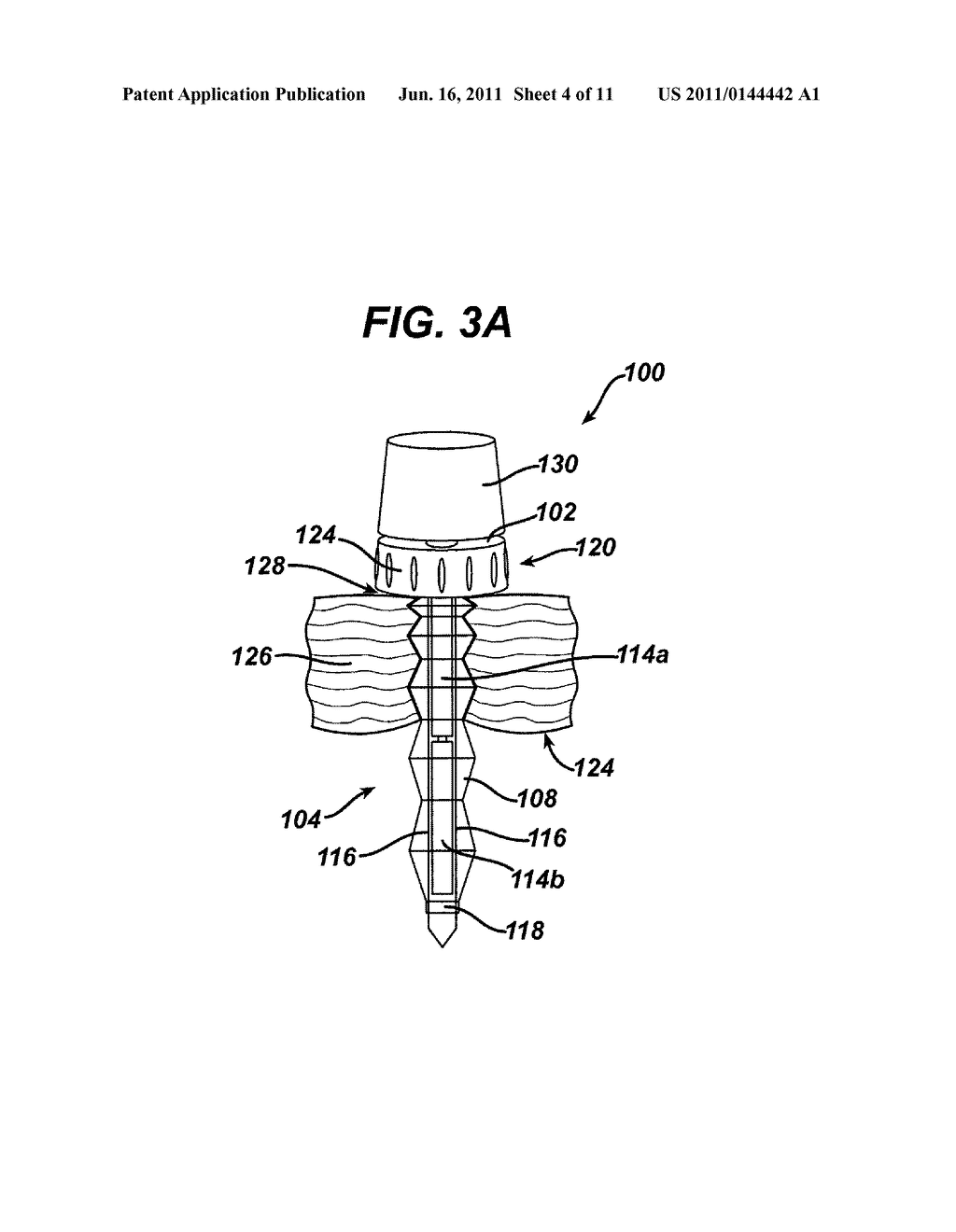 Methods and Devices for Providing Access into a Body Cavity - diagram, schematic, and image 05