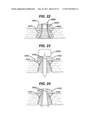 METHODS AND DEVICES FOR PROVIDING ACCESS THROUGH TISSUE TO A SURGICAL SITE diagram and image