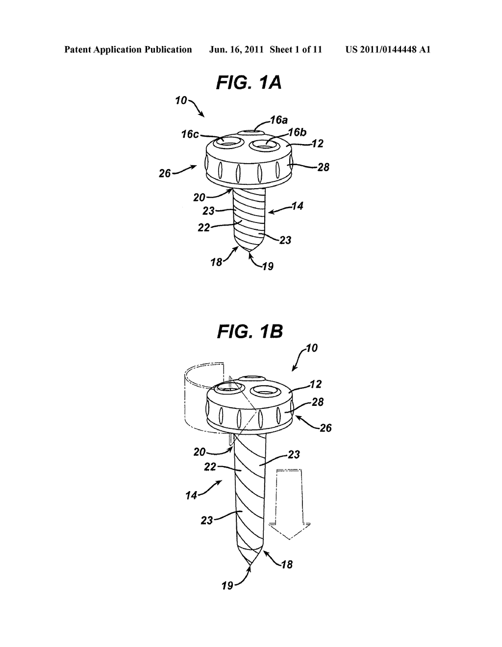 Methods and Devices for Providing Access into a Body Cavity - diagram, schematic, and image 02