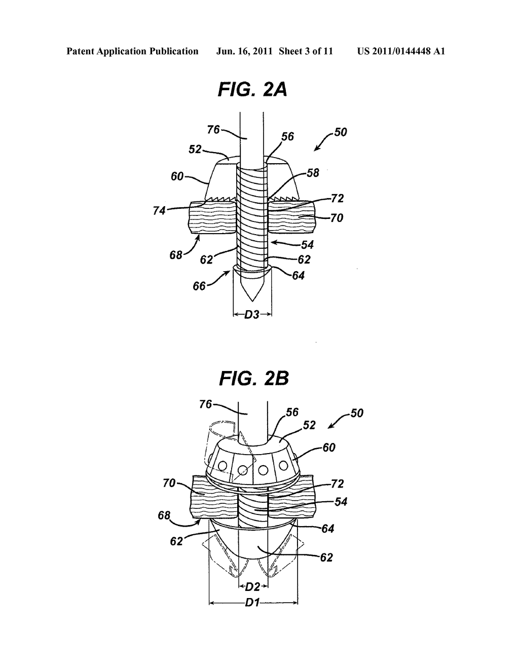 Methods and Devices for Providing Access into a Body Cavity - diagram, schematic, and image 04