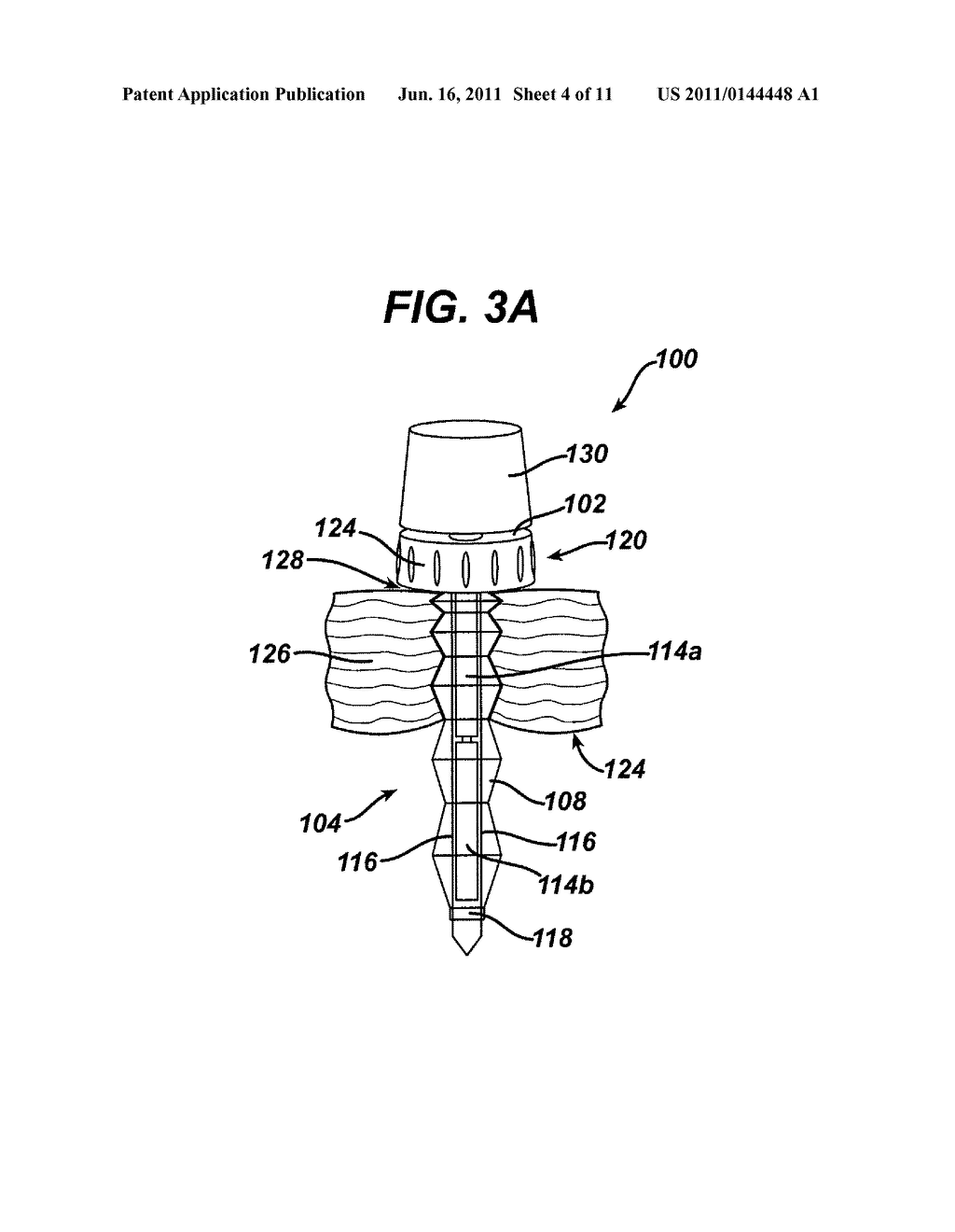 Methods and Devices for Providing Access into a Body Cavity - diagram, schematic, and image 05