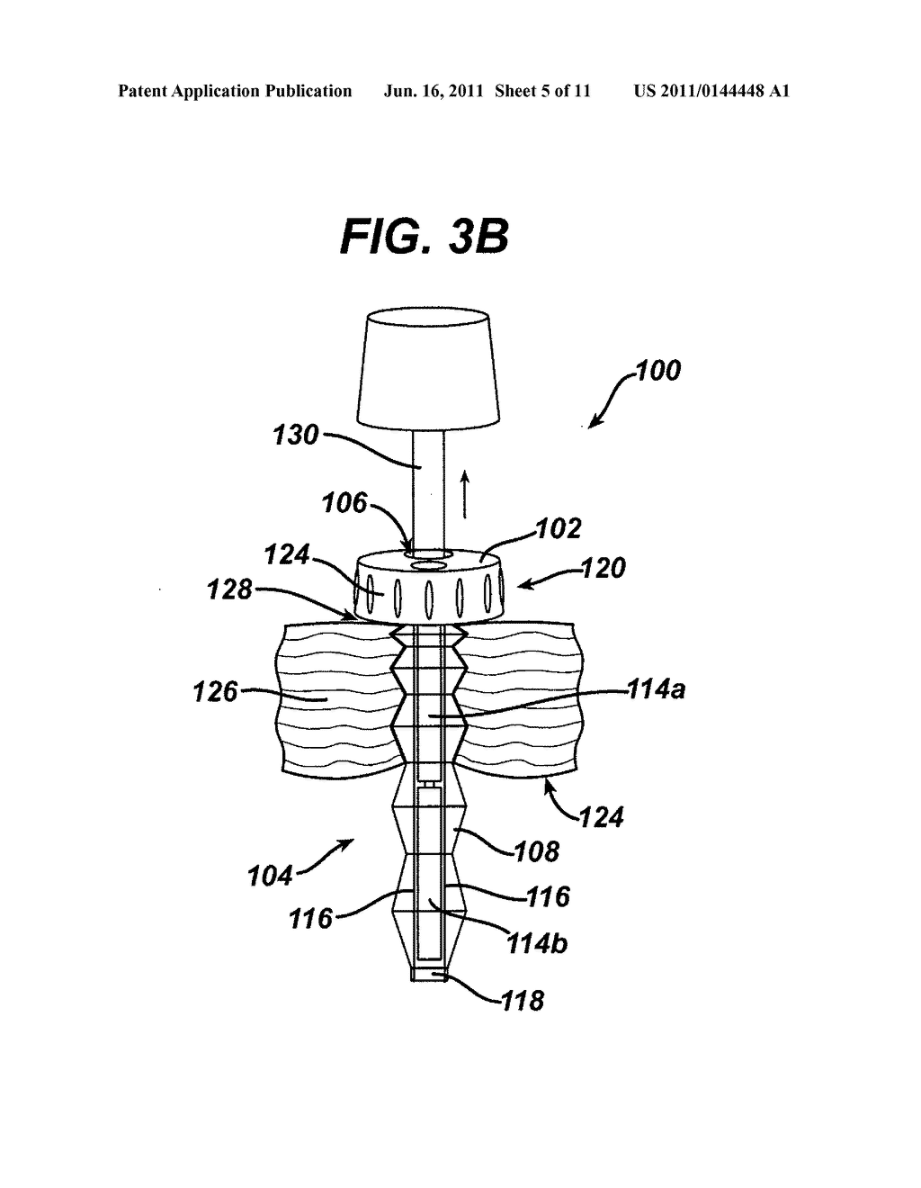 Methods and Devices for Providing Access into a Body Cavity - diagram, schematic, and image 06