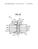 Methods and Devices for Providing Access into a Body Cavity diagram and image