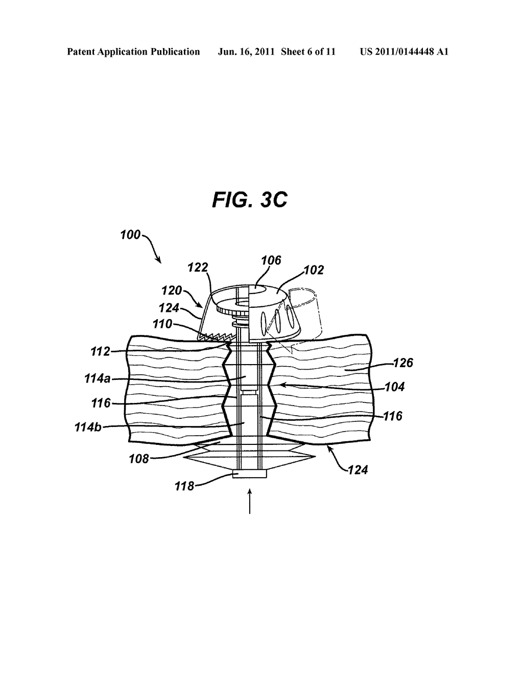 Methods and Devices for Providing Access into a Body Cavity - diagram, schematic, and image 07
