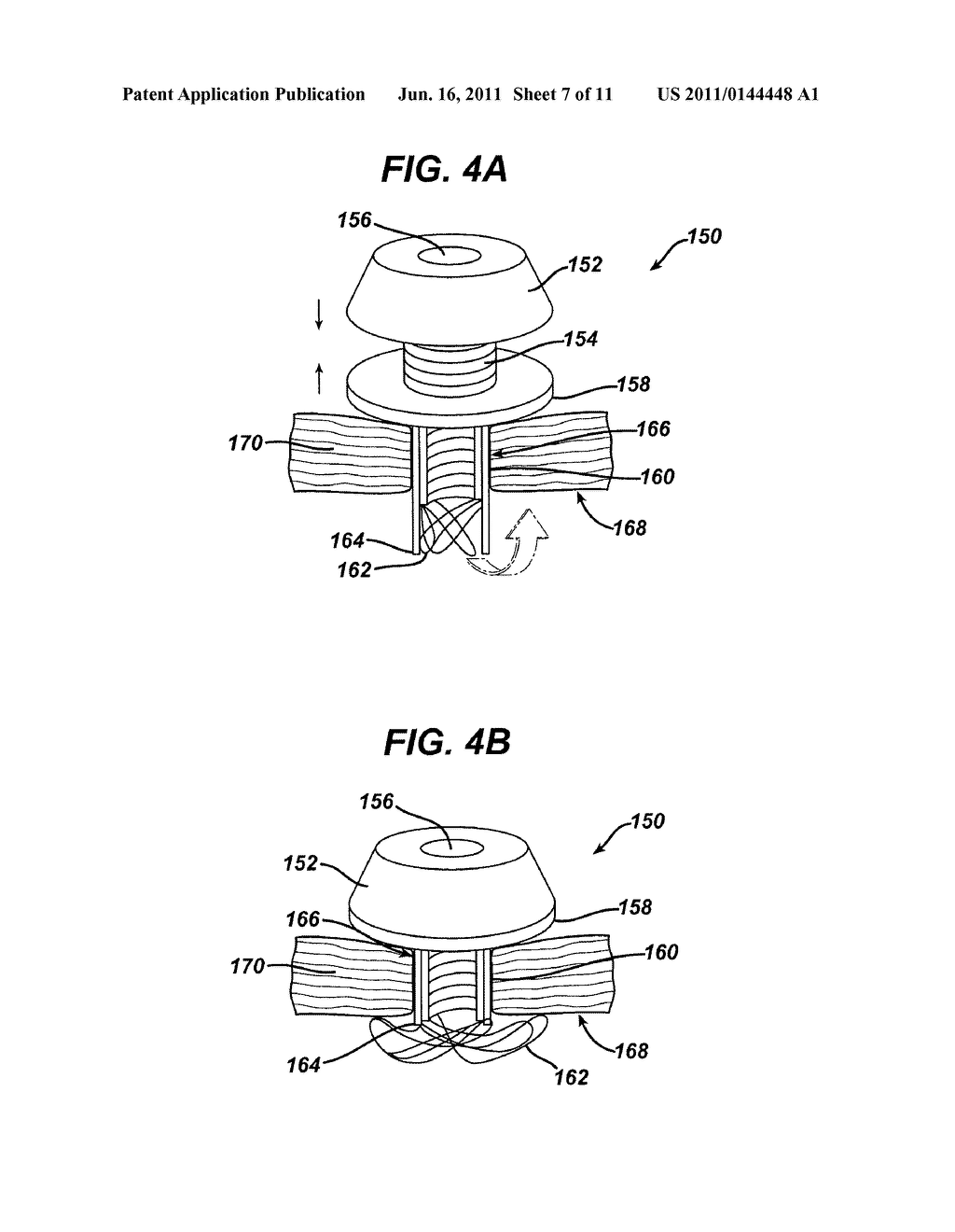 Methods and Devices for Providing Access into a Body Cavity - diagram, schematic, and image 08