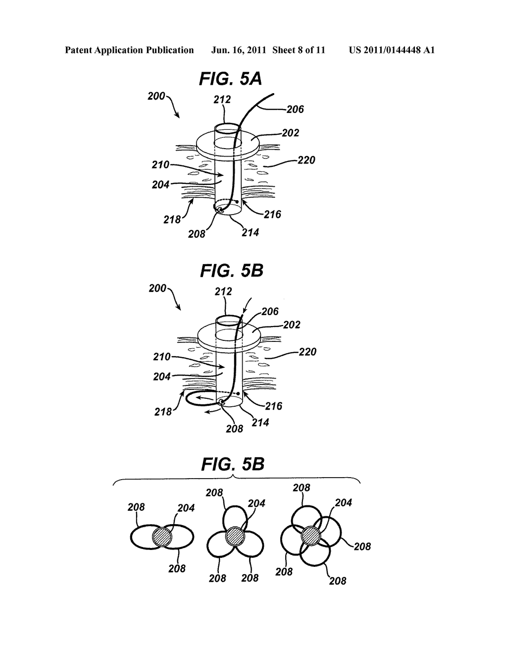 Methods and Devices for Providing Access into a Body Cavity - diagram, schematic, and image 09