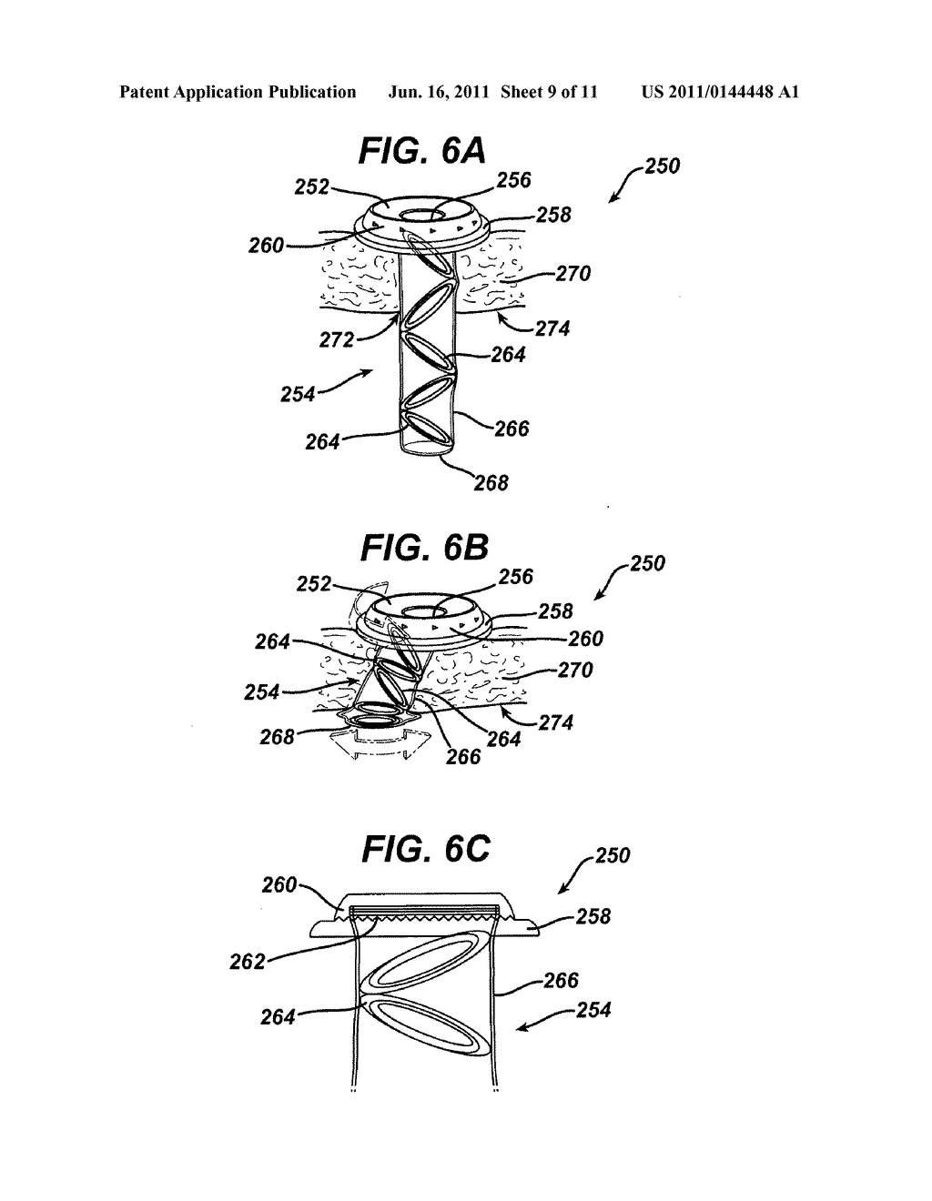 Methods and Devices for Providing Access into a Body Cavity - diagram, schematic, and image 10