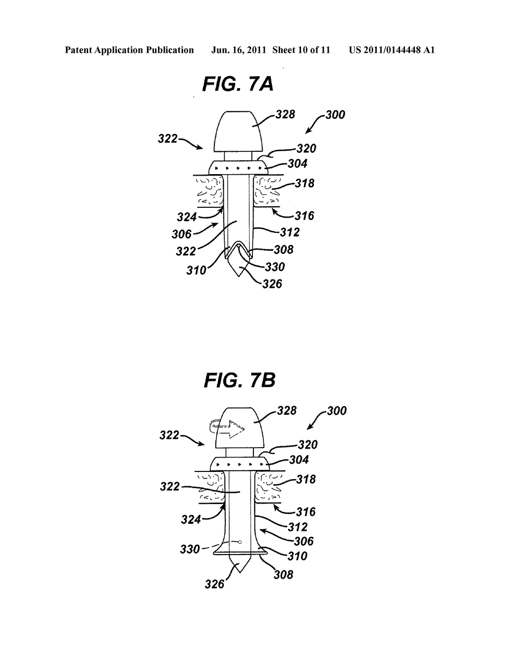 Methods and Devices for Providing Access into a Body Cavity - diagram, schematic, and image 11