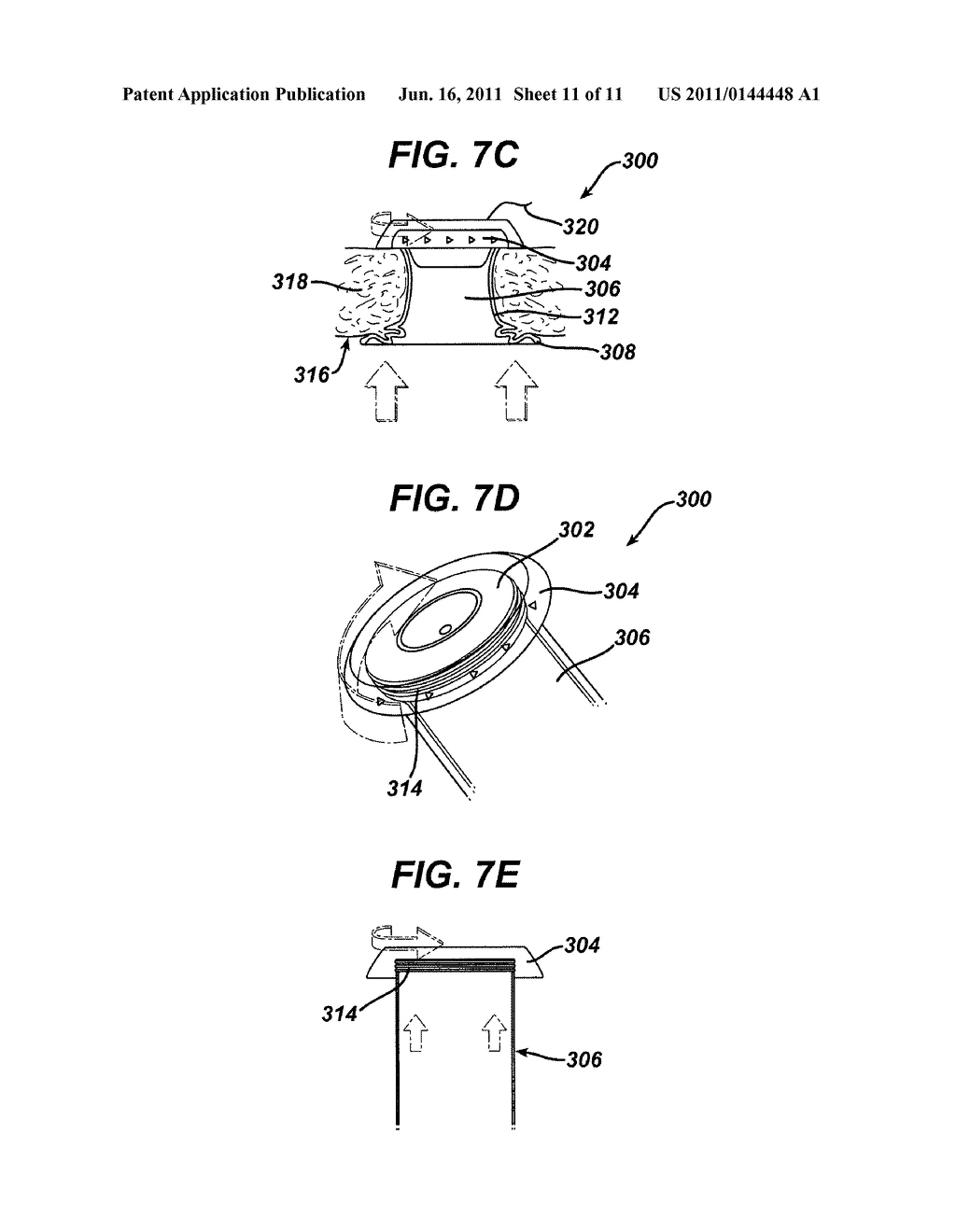 Methods and Devices for Providing Access into a Body Cavity - diagram, schematic, and image 12