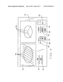 Targeted Treatment Delivery System diagram and image