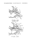 Targeted Treatment Delivery System diagram and image