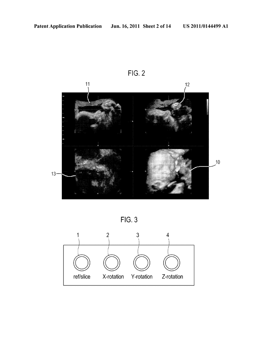 ULTRASOUND SYSTEM AND METHOD OF SELECTING SLICE IMAGE FROM     THREE-DIMENSIONAL ULTRASOUND IMAGE - diagram, schematic, and image 03