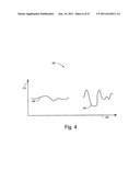 Cardiac Activation Sequence Monitoring and Tracking diagram and image