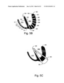 Cardiac Activation Sequence Monitoring and Tracking diagram and image