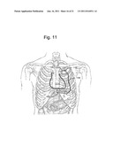 Cardiac Activation Sequence Monitoring and Tracking diagram and image