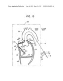 GUIDEWIRE diagram and image