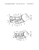 ANKLE SUPPORT WITH SPLINT AND METHOD OF USING SAME diagram and image