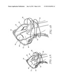 ANKLE SUPPORT WITH SPLINT AND METHOD OF USING SAME diagram and image