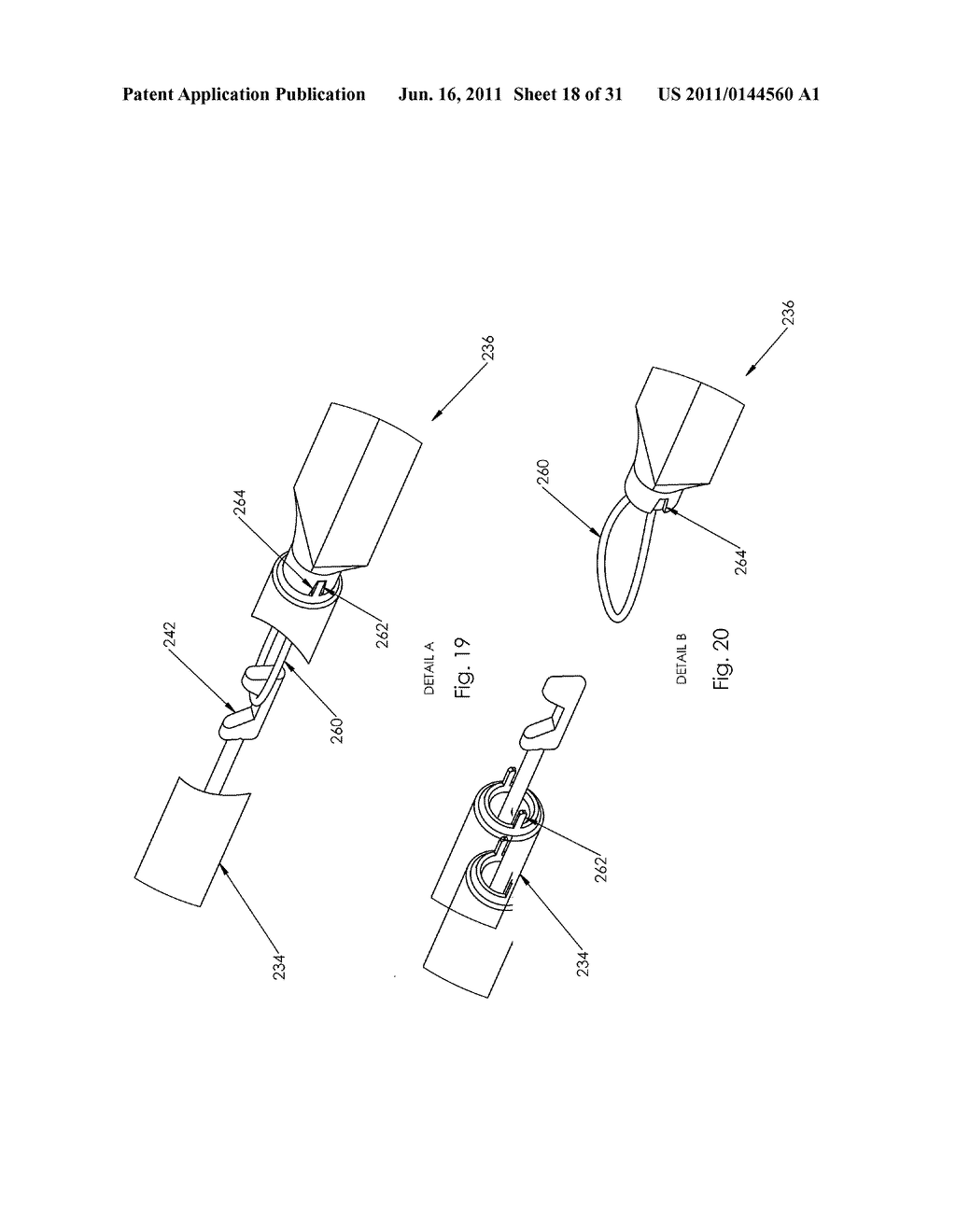 Incisionless Gastric Bypass Method And Devices - diagram, schematic, and image 19