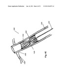 STEERING ENGAGEMENT CATHETER DEVICES, SYSTEMS, AND METHODS diagram and image