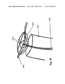 STEERING ENGAGEMENT CATHETER DEVICES, SYSTEMS, AND METHODS diagram and image