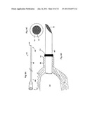 STEERING ENGAGEMENT CATHETER DEVICES, SYSTEMS, AND METHODS diagram and image