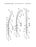 STEERING ENGAGEMENT CATHETER DEVICES, SYSTEMS, AND METHODS diagram and image