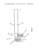 STEERING ENGAGEMENT CATHETER DEVICES, SYSTEMS, AND METHODS diagram and image